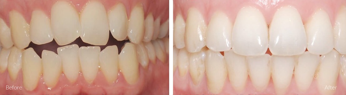 New Smile Dental Perth - Invisalign & orthodontics